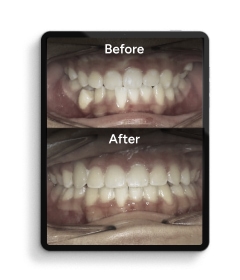 Digital Photos Before treatment and after treatment image